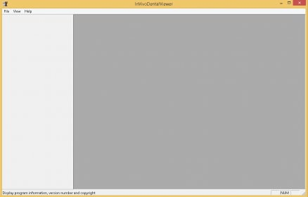 invivodentalviewer.software.informer.com